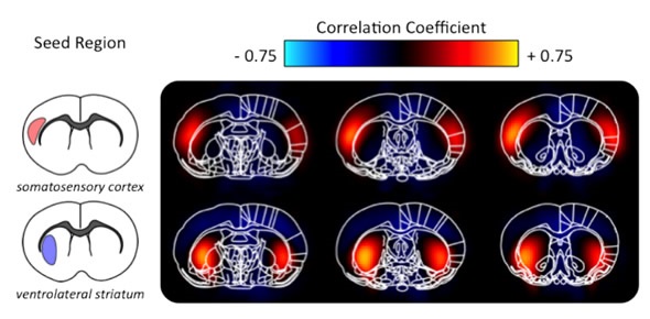 Seed based Functional Connectivity Maps (group average).