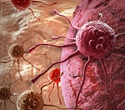 Individualized drug combinations improve cancer treatment outcomes