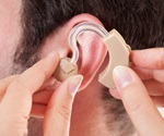 Hearing aid use has little impact on cognitive test scores