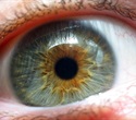 Australian researchers pinpoint specific genetic changes linked to severe AMD