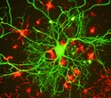 Tau biology expands beyond microtubules to neurodegeneration, metabolism and mental illness