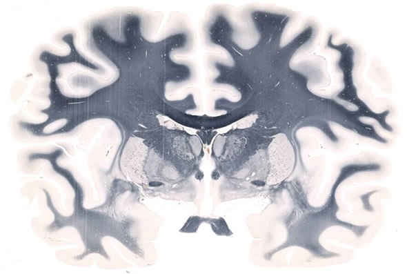 Whole Mount Brain - 5