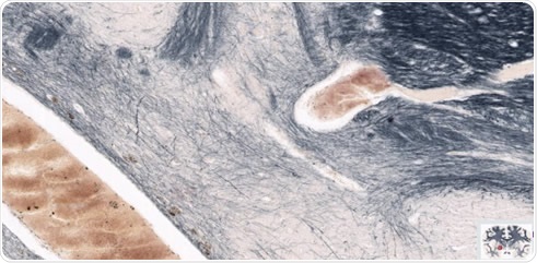 The brain in figure 1 magnified to highlight regions of interest in the left hemisphere.