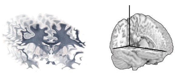 A series of whole brain images can be reconstructed using software to produce a 3D volume.