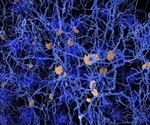 Targeting CSE enzyme may offer new pathways for Alzheimer’s treatment