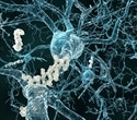 Study links high neuroinflammation in young people with Down Syndrome to Alzheimer's risk