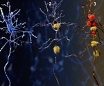 Lysophosphatidylcholines show gene-dependent effects in early Alzheimer’s disease