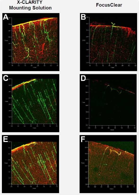 Confocal fluorescence microscopy of mouse brain slices