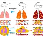 Naturally-occurring protein controls shape and activity of white blood cells to combat sepsis