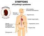 Cushing's Syndrome Signs and Symptoms