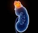 Mismatch in kidney tests may reveal hidden health risks