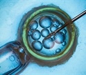 Study: Common test to assess viability of IVF embryos may be flawed