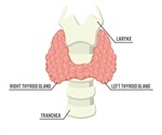 Overactive Thyroid and Tremors