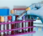 Blood biomarkers predict risk of multimorbidity in older adults