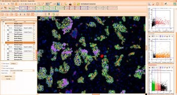 StrataQuest Analysis Software from TissueGnostics