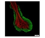 Olympus IXplore SpinSR10 imaging system enables researchers to observe fine details in live cells