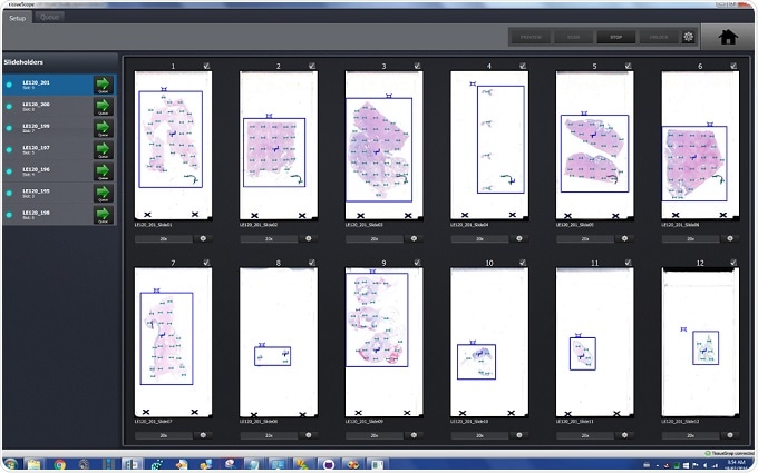 Huron’s interface gives users more power to tackle difficult slides