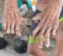 Ancient DNA sheds light on the origins of leprosy in the Americas