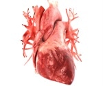 Bacterial enzyme linked to heart complications in pneumonia