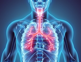 Researchers discover how Mycoplasma pneumoniae acquires cholesterol from human hosts