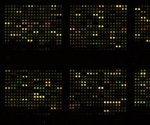 DNA microarray