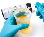 Urine Composition: What’s Normal?