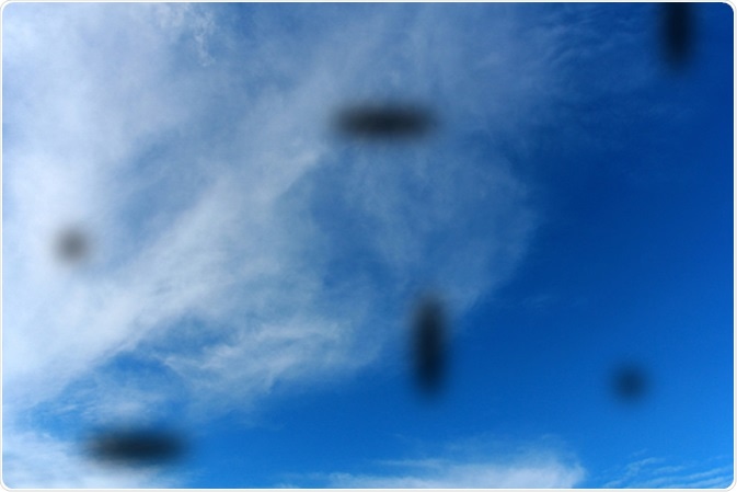 Eye floaters (myodesopsias) emerge as a consequence of opacities developed in the vitreous fluid of the eye. Image Credit: Hareluya / Shutterstock