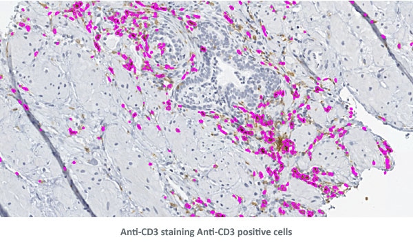 AntiCD3 Det CD3Pos