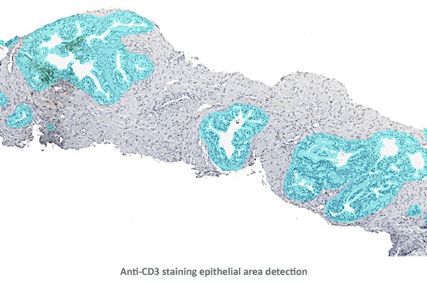 AntiCD3 EpiDetection