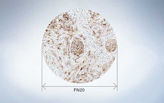 Excellent Optical Performance for Flat Images