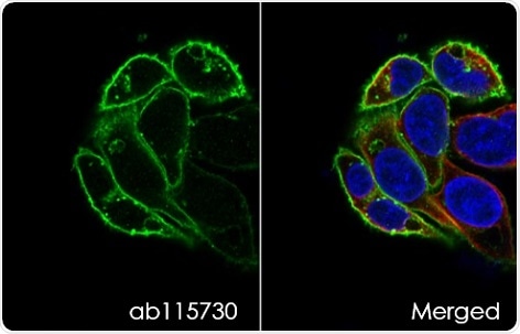 GLUT1 staining of HEPg2 cells. Anti-glucose transporter GLUT antibody (ab115730) was used at a dilution of 1/100 with Alexa Fluor® 488 goat anti-rabbit secondary antibody (ab150077). Cells were counterstained with DAPI and tubulin was also stained (red).