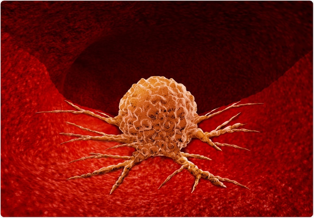 Cancer cell. Lightspring - Shutterstock