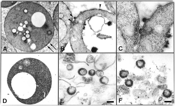 Electron microscopic examination of yeast spheroplasts expressing HIV Gag protein and VLPs purified from the culture medium. (A–C) Yeast spheroplasts expressing Gag protein. Image Credit: PNAS