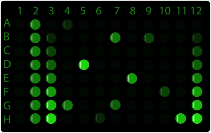 By Alila Medical Media