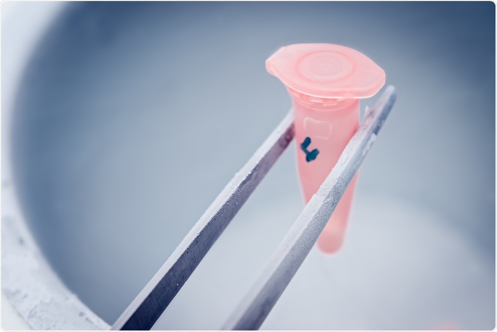 Cyropreserved tumor cells - By Elena Pavlovich