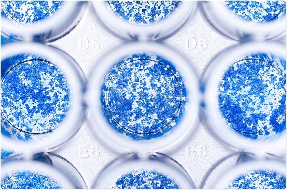 Neuronal cells in 96 well-plate - akh_photo