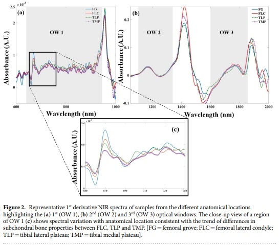 Representative NIR Spectra Bone Samples By Afara, Florea, et al. Characterizing human subchondral bone properties using near-infrared (NIR) spectroscopy, via Scientific Reports