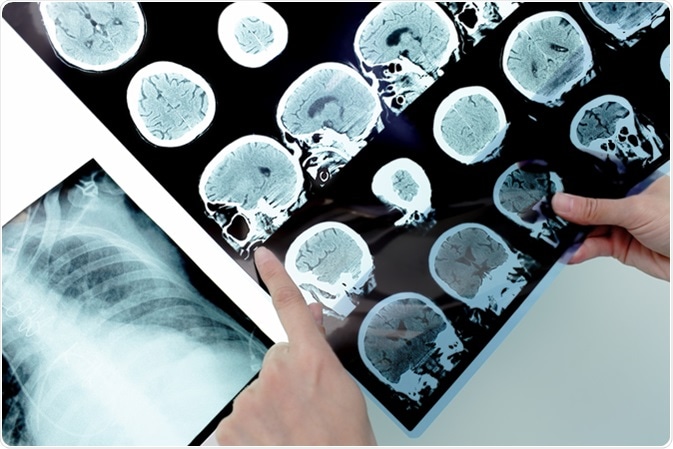 Image Credit: Sfam_photo / Shutterstock