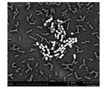 Studying Foodborne Pathogens using Electron Microscopy