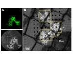 Researchers transplant retinal sheets derived from human embryonic stem cells in retinal degeneration mouse models