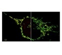 New 2D Superresolution mode for ZEISS Airyscan offers higher resolution in live cell imaging