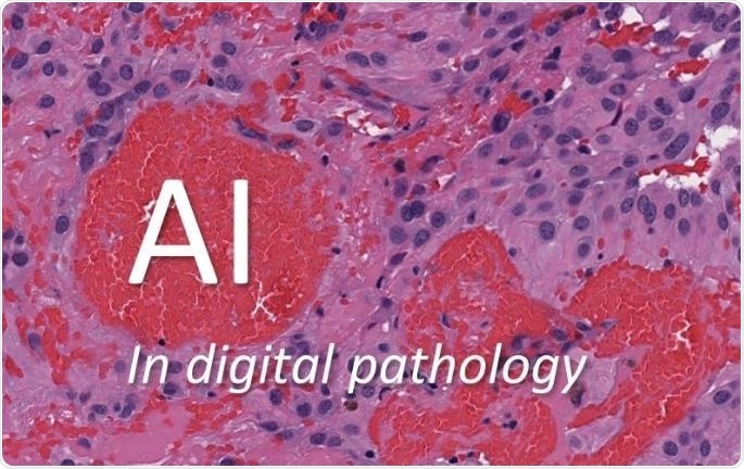 AI in digital pathology