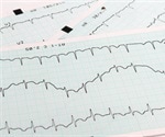 Preventive ventricular tachycardia ablation cuts down ICD shocks and hospitalizations