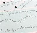 Study sheds light on why women have faster heartbeats than men