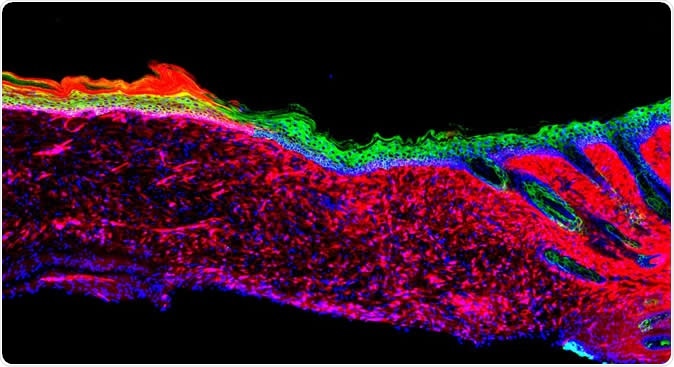 The image represents the first proof of principle for the successful regeneration of a functional organ (the skin) inside a mammal, by a technique known as AAV-based in vivo reprogramming. Epithelial (skin) tissues were generated by converting one cell type (red: mesenchymal cells) to another (green: basal keratinocytes) within a large ulcer in a laboratory mouse model.