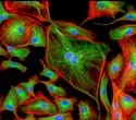 Fluorescence Microscopy: Choosing the Right lllumination System