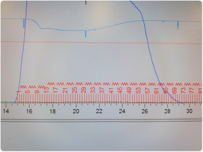 Chromatography results