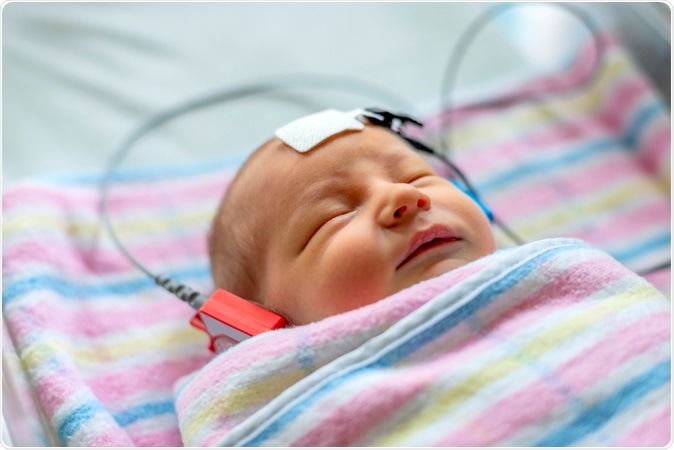 Autism could be detected early using a hearing test finds research. Image Credit: Midkhat Izmaylov