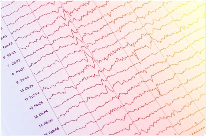 EEG - electroencephalogram output - Image Credit: Chaikom / Shutterstock