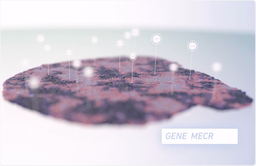 10x Spatial genomics profiling
